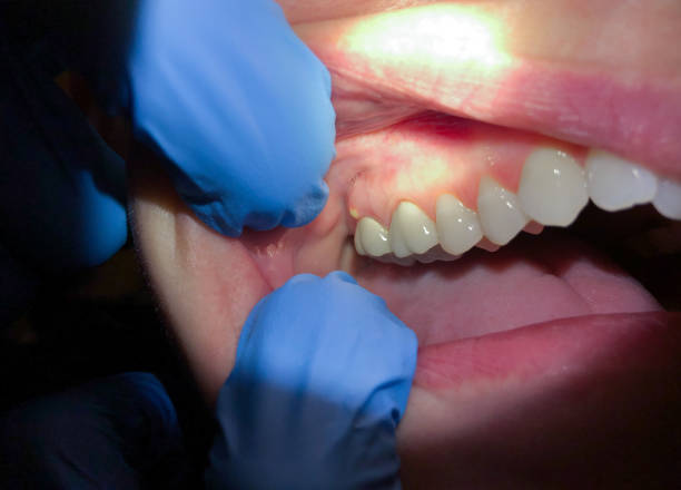 Best After-Hours Dental Care in Shanor Northvue, PA