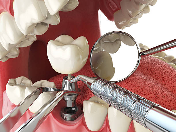 Best Emergency Treatment for Oral Infections in Shanor Northvue, PA